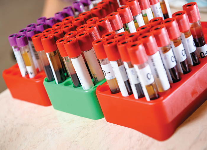 تحليل الدم الشامل ماذا يكشف